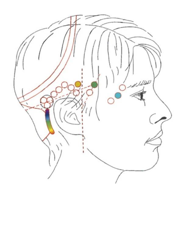 Bars chart of points on the head